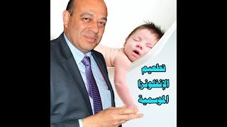 تطعيم الانفلونزا الموسمية و أهميته لحماية الأطفال د. أسامه حسين إستشارى طب الأطفال و حديثى الولادة