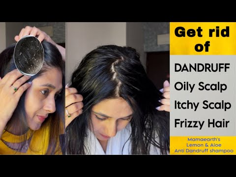 Mamaearth's Lemon & Aloe Anti Dandruff Shampoo | Effectively treat Dandruff #dandruff uff