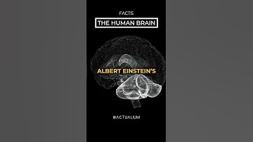 Unbelievable Facts About The Human Brain You WON