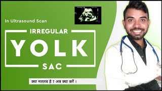 irregular yolk sac | irregular yolk sac at 6 weeks | Irregular yolk sac shape in ultrasound during p