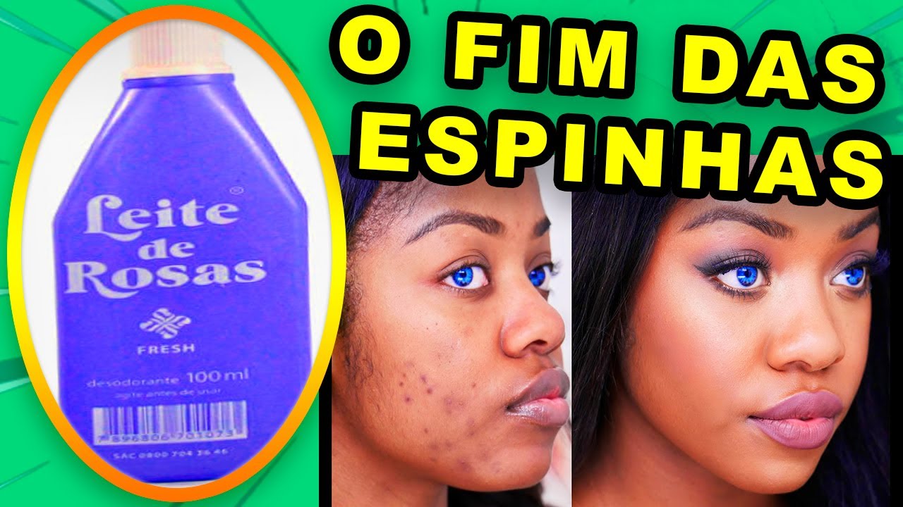 Como ACABAR Com AS ESPINHAS? Use o LEITE DE ROSAS e VEJA as Espinhas ...