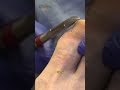 How Podiatrists Get Toenails Perfectly Smooth #nailcare #satisfying