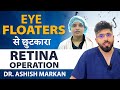Eye floaters treatment  floaterectomy eye surgery