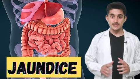 Animasi 3D penyakit kuning | Penyebab dan gejala penyakit hati obstruktif hemolitik | Biologi CBSE kelas 11 NEET