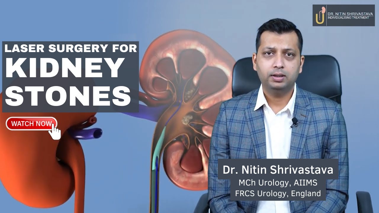 What is laser surgery for treating kidney stones? Dr. Nitin Shrivastava
