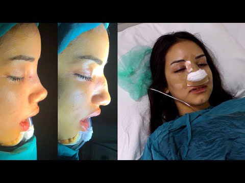 Video: Rus Bir Milyarderin Kızı, Reenkarnasyondan Sonra Güzellik Ve Kişisel Bakım Hakkında Blog Yazan Bir Kız Olan üç Estetik Ameliyattan Sonra Nasıl Değişti?