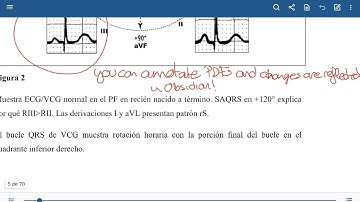 Obsidian Handwritten Notes quick demo