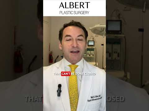 Video thumbnail: Dr. Albert performs closed rhinoplasty for every case whether it's your 1st or 5th rhinoplasty. · Albert Plastic Surgery New York