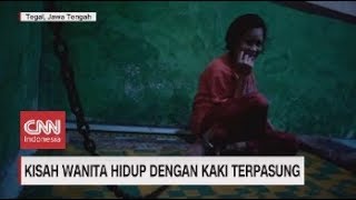 Kisah Pilu Wanita Hidup dengan Kaki Terpasung