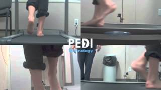 Video Gait Analysis : Foot function Orthotics heel pain Mississauga Brantford Podiatry Chiropody