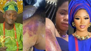 THIS IS WHAT HAPPENED BETWEEN ME & PORTABLE: BEWAJI, PORTABLE 1ST WIFE EXPLAIN AFTER SHE WAS BEATEN