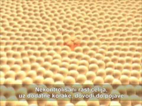 Video: Kako prevladati seksualnu ovisnost