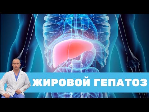 Жировой гепатоз. Как лечить?