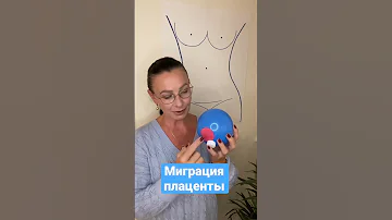 Что такое миграция плаценты?