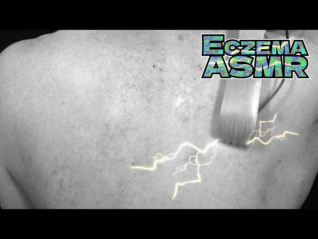 【ウトウトしてしまうアトピー性皮膚炎ASMR】超痒い背中を孫の手で掻く音/癒し/リラックス効果/睡眠導入/マッサージ【モノクロ版】