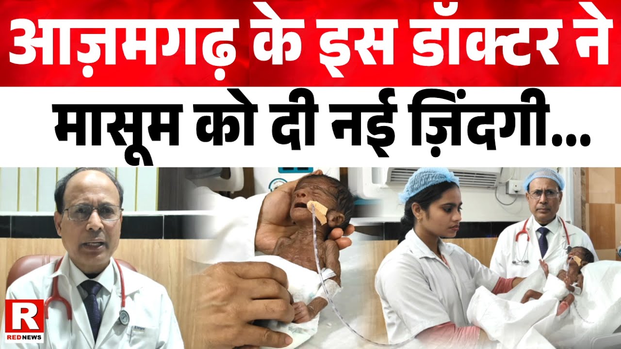 आज़मगढ़ के इस डॉक्टर ने मासूम को दी नई ज़िंदगी...