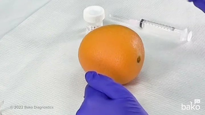 Fine Needle Aspiration Procedure