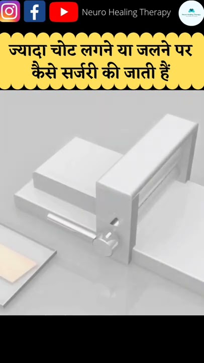 Injury Surgery 3d animation #shorts - YouTube