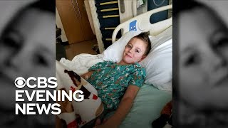 Minnesota health officials on the lookout for rare nervous system disorder