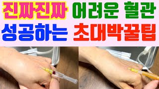 가늘고/잘 터지고/꼬불거리고/깊고/짧고/노인/ 소아/등 엄청나게 어려운 혈관 iv 실패없이 성공할수 있는 초대박꿀팁 공개합니다!! 안보면 후회하실 거에요