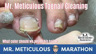 👣Satisfying Impacted Toenail Cleaning👣 #MrMeticulousMarathon