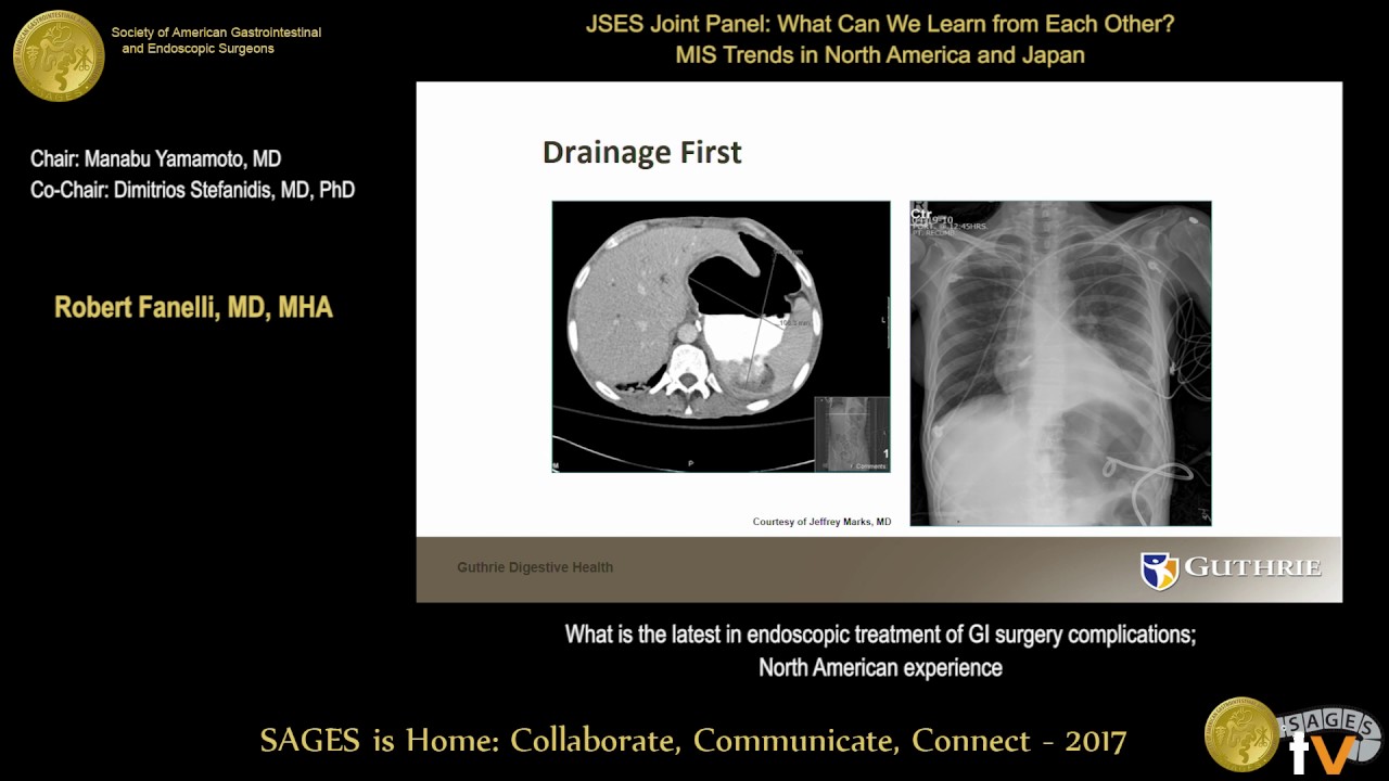Endoscopic management of complications associated with GI surgery YouTube