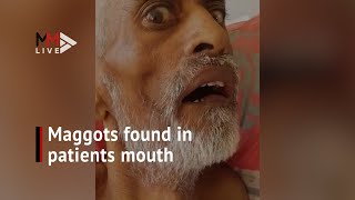 Belatung ditemukan di mulut pasien Durban pasca amputasi