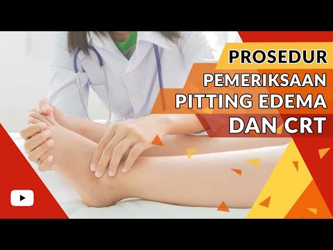 Prosedur Keperawatan - Pemeriksaan Pitting Edema dan Capillary Refill Time (CRT)