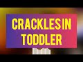 Crakles in toddler