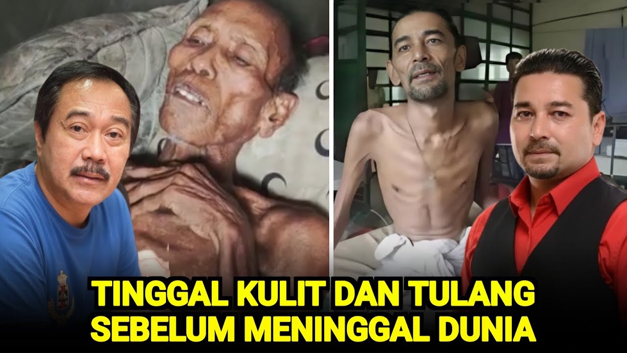 Sangat Miris, Tubuh 8 Artis Ini HanyaTinggal Kulit Dan Tulang Sebelum Meninggal Dunia