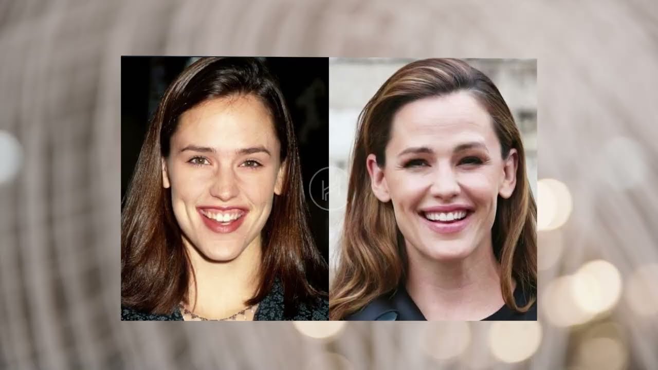 Celebrity Smile Talks: Seville Dental Aesthetics