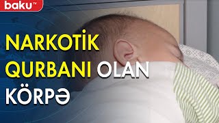 Narkotik qurbanı olan körpənin ürək ağrıdan vəziyyəti - Baku TV