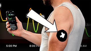 I INJECTED This Sensor to HACK My Metabolism  This is What I Learned (Ultrahuman M1 Live)