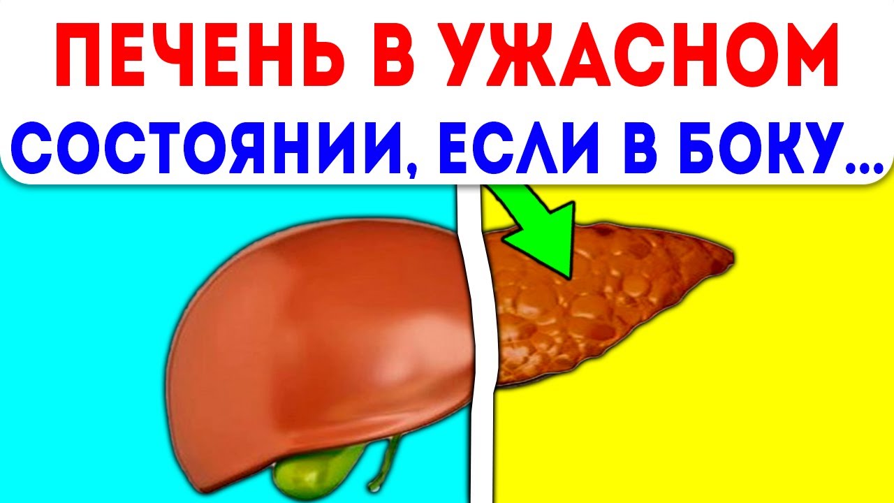 ОЖИВЛЯЕМ ПЕЧЕНЬ! Печень и желчный оживятся после этого удивительного ...