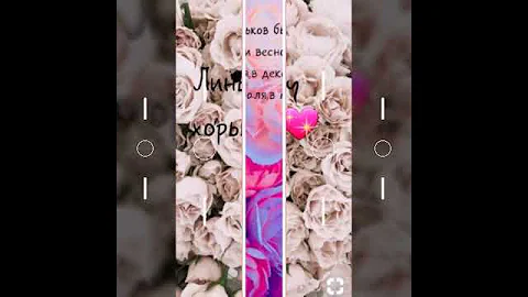 Что делать если хорёк теряет шерсть?Как проходит линька у хорьков!💖💜