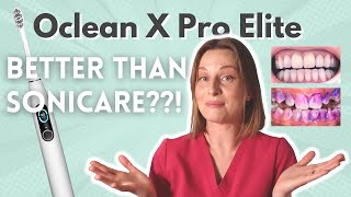 Oclean X Pro Elite Electric Toothbrush Review Vs Sonicare SenseIQ | Discount Codes!