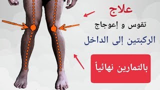 علاج تقوس و إعوجاج الركبتين | بالتمارين نهائياً