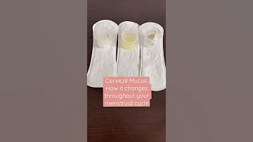 Discharge Am I Normal Cervical Mucus Changes Throughout Your Cycle Shorts 