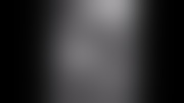 Asvide: Cine cardiac MRI with SSFP contrast (3 T) of a patient with supraventricular arrhythmias.