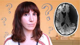 ¿Se puede vivir sin parte del cerebro?
