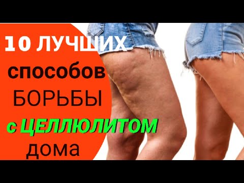 👆10 ПРОВЕРЕННЫХ СПОСОБОВ, КАК ИЗБАВИТЬСЯ ОТ ЦЕЛЛЮЛИТА В ДОМАШНИХ УСЛОВИЯХ! Антицеллюлитный массаж
