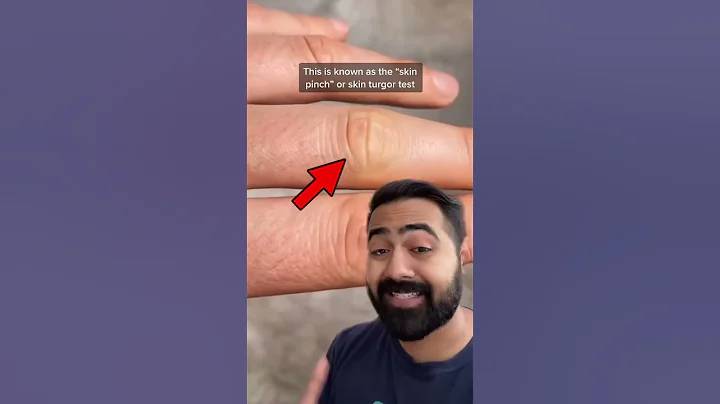 Dehydration check! #shorts