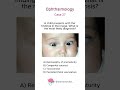 Ophthalmology - Case 27