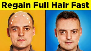 Hair Loss Treatment for Men, Certified Hair Surgeon Approved | Hair Transplant Results