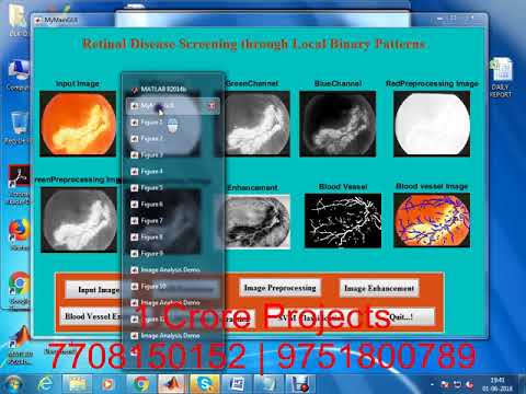 Retinal Disease Screening