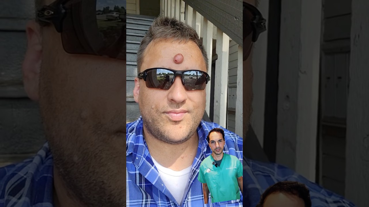 I love Oakleys! #Neurofibroma #Doctor #MedicalSchool #Tumor #Surgeon #Sunglasses #Educational