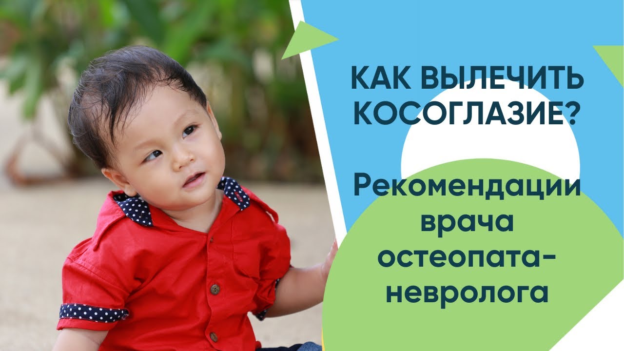 Что такое косоглазие? Причины развития косоглазия. Эффективность остеопатии при косоглазии