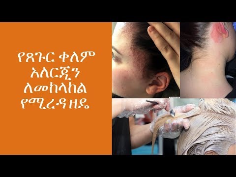Ethiopia : የጸጉር ቀለም አለርጂን ለመከላከል የሚረዳ ዘዴ (home treatment for hair dye allergy)