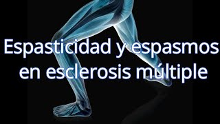 La espasmo muscular pierna 10 de izquierda icd