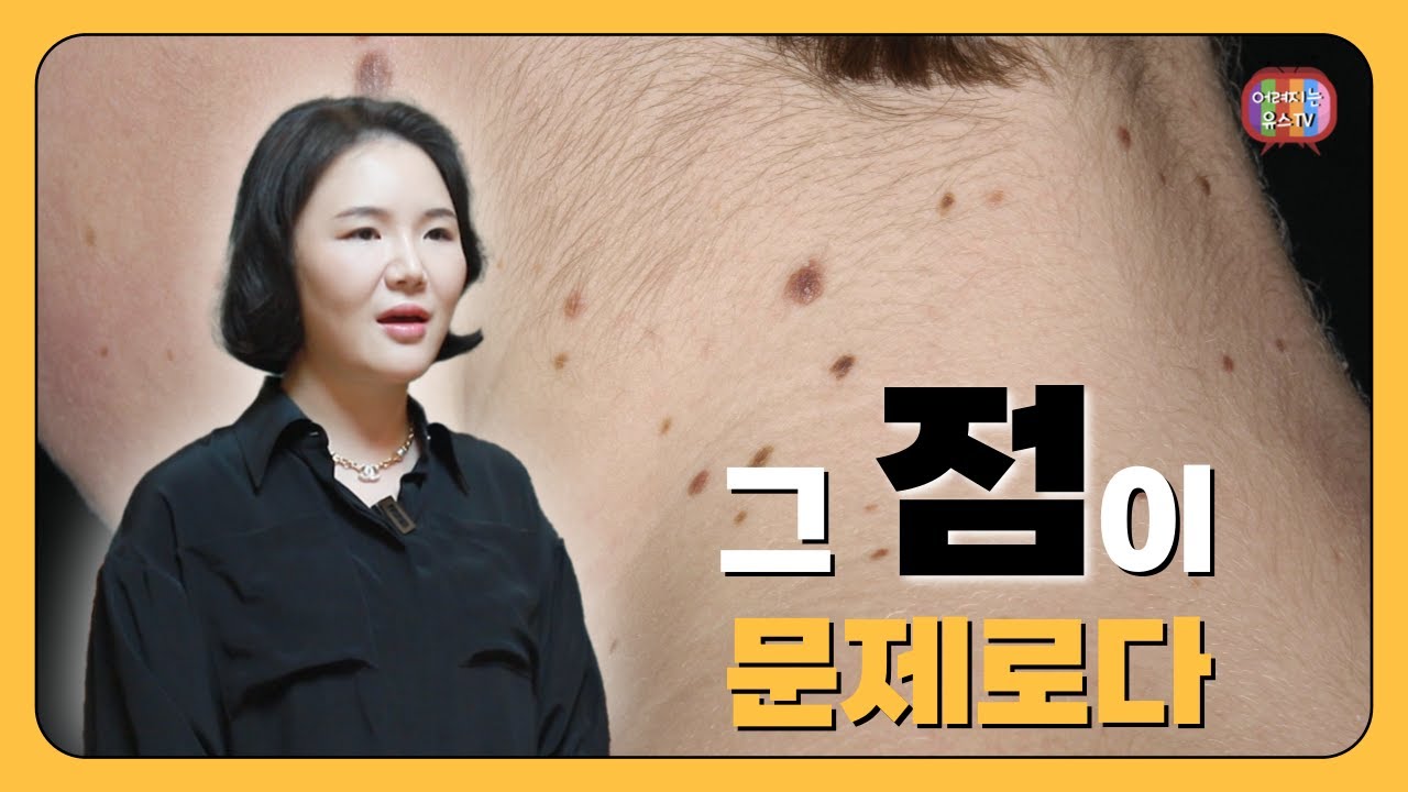 점이 생기는 원인, 얼굴 점 제거 방법 점뺀후관리 점빼고재생테이프 얼마나 붙여야 하나요? - YouTube